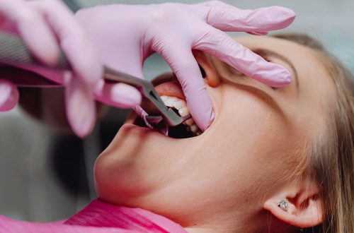 Tooth_Extraction_001