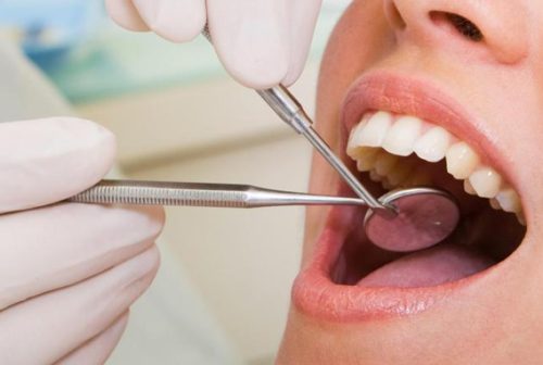 full-mouth-rehabilitation-banner