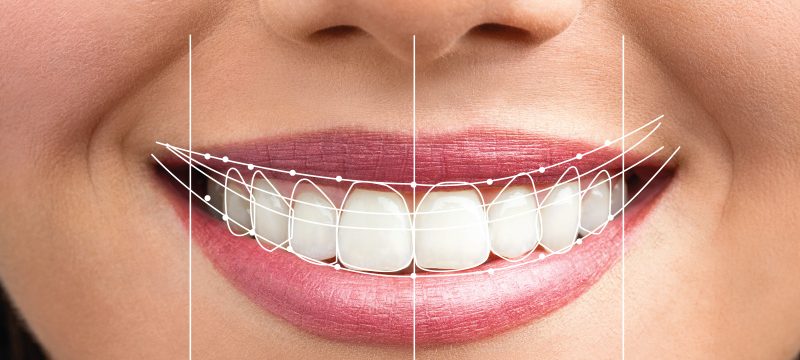 smile-prev-800 smile-prev-800